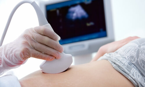 woman getting ultrasound diagnostic from doctor